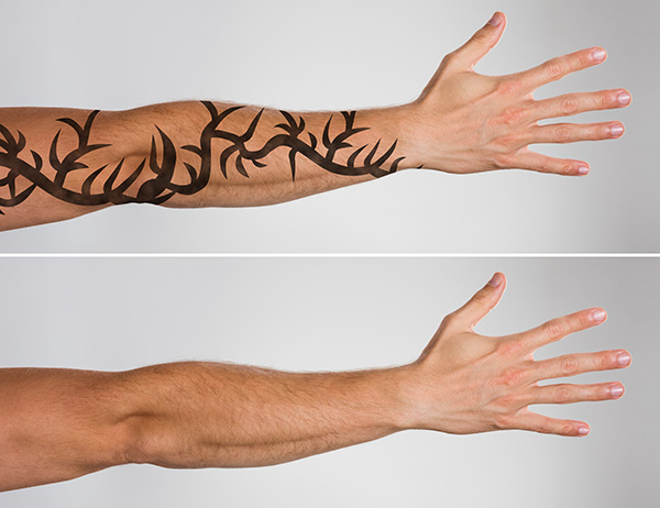 mockup of male arm, one with tattoo example above and no tattoo below