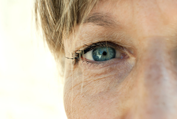 middle aged woman with eye wrinkles