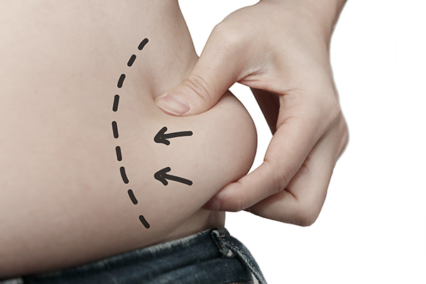 Person pinching love handles with marker arrows and dashed lines drawn on body