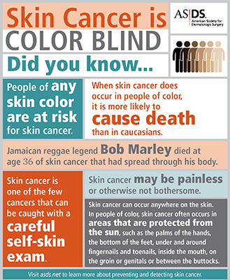Skin Cancer is Color Blind infographic