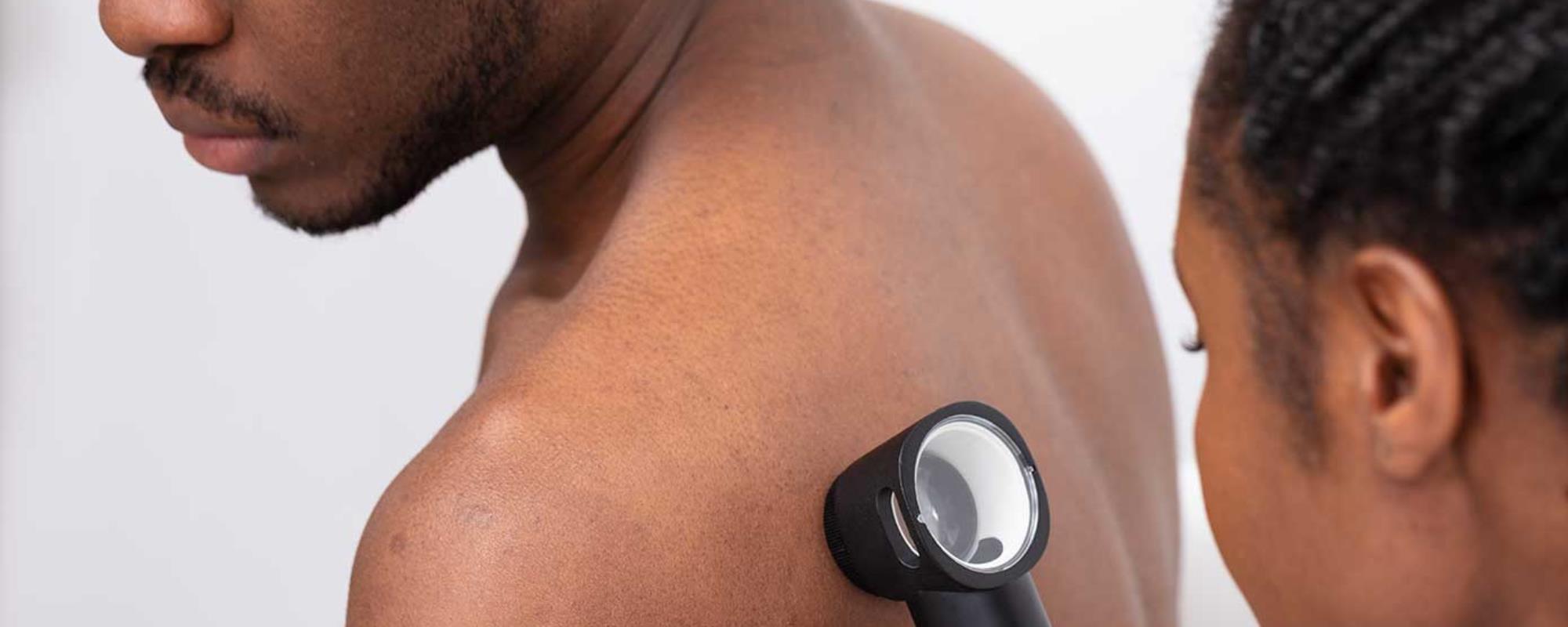 A male patient receiving a cancer screening on their upper left back